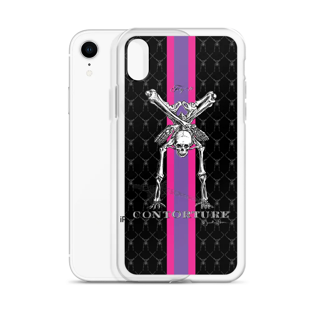 Contorture iPhone Case: SuperStripe Contortion Skeleton